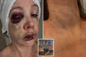 cincinnati-brawl-woman-injuries-comp-1.jpg