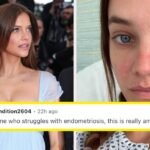 Barbara Palvin Being pregnant After Endometriosis Struggles